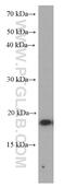 Tumor Necrosis Factor antibody, 60291-1-Ig, Proteintech Group, Western Blot image 