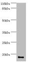 S100 Calcium Binding Protein A9 antibody, A60762-100, Epigentek, Western Blot image 