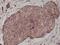 Cadherin 1 antibody, M00063-3, Boster Biological Technology, Immunohistochemistry paraffin image 