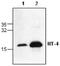 Neurotrophin 4 antibody, GTX59802, GeneTex, Western Blot image 