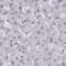 PDZ Binding Kinase antibody, NBP2-58043, Novus Biologicals, Immunohistochemistry paraffin image 