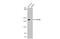 Collagen Type IV Alpha 1 Chain antibody, GTX636771, GeneTex, Western Blot image 