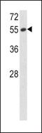 Serpin Family F Member 1 antibody, PA5-14199, Invitrogen Antibodies, Western Blot image 