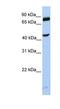 SET And MYND Domain Containing 3 antibody, NBP1-79394, Novus Biologicals, Western Blot image 