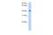 Pregnancy Specific Beta-1-Glycoprotein 5 antibody, A11855, Boster Biological Technology, Western Blot image 