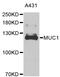Mucin 1, Cell Surface Associated antibody, STJ24642, St John