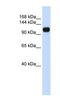 Kiaa0692 antibody, NBP1-70407, Novus Biologicals, Western Blot image 