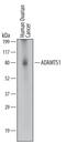 ADAM Metallopeptidase With Thrombospondin Type 1 Motif 1 antibody, MAB2197, R&D Systems, Western Blot image 
