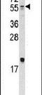 Bone Morphogenetic Protein 10 antibody, PA5-11711, Invitrogen Antibodies, Western Blot image 