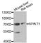 Serine Peptidase Inhibitor, Kunitz Type 1 antibody, A6411, ABclonal Technology, Western Blot image 