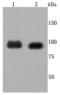 Fibroblast Growth Factor Receptor 3 antibody, A00200-2, Boster Biological Technology, Western Blot image 