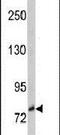 Neurotrophic Receptor Tyrosine Kinase 3 antibody, PA5-14749, Invitrogen Antibodies, Western Blot image 