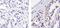Cadherin 1 antibody, MA5-12547, Invitrogen Antibodies, Immunohistochemistry paraffin image 