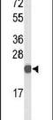 CXXC Finger Protein 4 antibody, PA5-26391, Invitrogen Antibodies, Western Blot image 