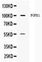 Fibroblast Growth Factor Receptor 1 antibody, A00098, Boster Biological Technology, Western Blot image 