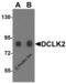 Serine/threonine-protein kinase DCLK2 antibody, 5635, ProSci Inc, Western Blot image 