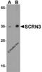 Secernin 3 antibody, 5853, ProSci Inc, Western Blot image 