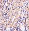 Glutathione Synthetase antibody, GTX81665, GeneTex, Immunohistochemistry paraffin image 