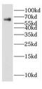 Dihydropyrimidinase Like 3 antibody, FNab01988, FineTest, Western Blot image 