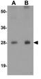 Transmembrane 4 L Six Family Member 1 antibody, GTX31430, GeneTex, Western Blot image 