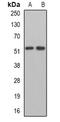 Membrane Palmitoylated Protein 1 antibody, orb341027, Biorbyt, Western Blot image 