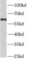 Aprataxin and PNK-like factor antibody, FNab00484, FineTest, Western Blot image 