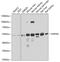 Hepatocyte Nuclear Factor 4 Alpha antibody, GTX54098, GeneTex, Western Blot image 