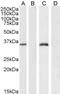 Forkhead Box L2 antibody, GTX25096, GeneTex, Western Blot image 