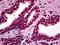 Myocyte Enhancer Factor 2A antibody, orb94706, Biorbyt, Immunohistochemistry paraffin image 