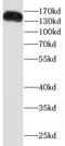 Drosha Ribonuclease III antibody, FNab02540, FineTest, Western Blot image 