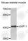 Immunoglobulin Superfamily Member 11 antibody, A5177, ABclonal Technology, Western Blot image 