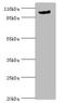 Major Vault Protein antibody, A56483-100, Epigentek, Western Blot image 