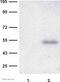 RAB27A, Member RAS Oncogene Family antibody, ab55667, Abcam, Western Blot image 