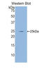 Glutamate-Cysteine Ligase Catalytic Subunit antibody, LS-C294229, Lifespan Biosciences, Western Blot image 