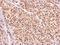 High Mobility Group Box 1 antibody, GTX127972, GeneTex, Immunohistochemistry paraffin image 