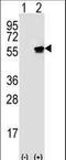 Serine/threonine-protein kinase 51PK antibody, LS-C100604, Lifespan Biosciences, Western Blot image 