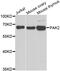 P21 (RAC1) Activated Kinase 2 antibody, abx006917, Abbexa, Western Blot image 