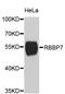 RB Binding Protein 7, Chromatin Remodeling Factor antibody, abx127030, Abbexa, Western Blot image 