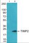 TIMP Metallopeptidase Inhibitor 2 antibody, abx013211, Abbexa, Western Blot image 