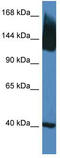 Solute Carrier Family 12 Member 5 antibody, TA333735, Origene, Western Blot image 