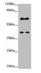 Synaptonemal Complex Central Element Protein 1 antibody, LS-C676565, Lifespan Biosciences, Western Blot image 