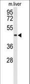 Chitinase Acidic antibody, LS-C168732, Lifespan Biosciences, Western Blot image 