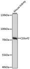 Twinkle protein, mitochondrial antibody, LS-C748482, Lifespan Biosciences, Western Blot image 