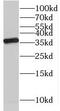 NSF Attachment Protein Beta antibody, FNab05546, FineTest, Western Blot image 