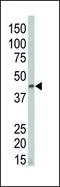 Death Associated Protein Kinase 2 antibody, PA5-14045, Invitrogen Antibodies, Western Blot image 