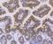 Actinin Alpha 4 antibody, NBP2-75404, Novus Biologicals, Immunohistochemistry paraffin image 