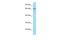 Villin Like antibody, A11915, Boster Biological Technology, Western Blot image 