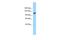 GEM Interacting Protein antibody, A07655, Boster Biological Technology, Western Blot image 