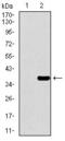 Paired Box 3 antibody, GTX60758, GeneTex, Western Blot image 