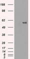 Fyn Related Src Family Tyrosine Kinase antibody, LS-C797083, Lifespan Biosciences, Western Blot image 